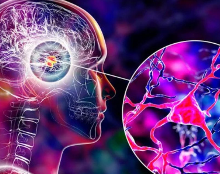 ¿Se detectó el detonante del Parkinson? Científicos creen que si