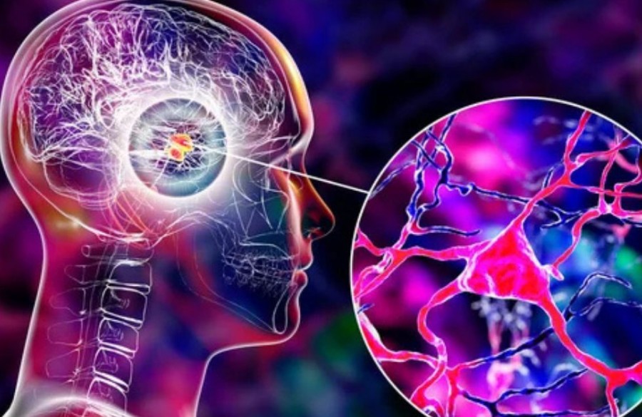 ¿Se detectó el detonante del Parkinson? Científicos creen que si