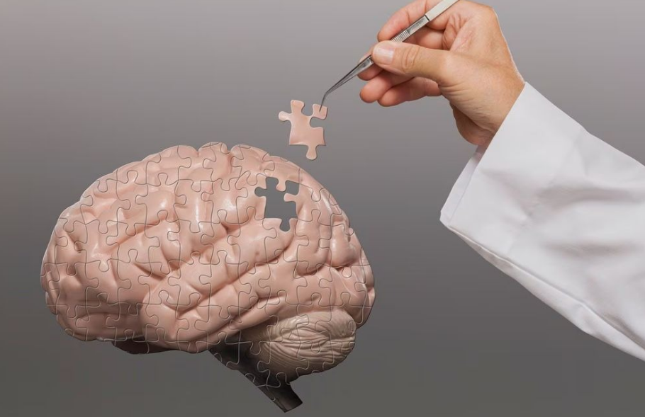 ¿Qué es el Parkinson y cómo se relaciona con los oligómeros?