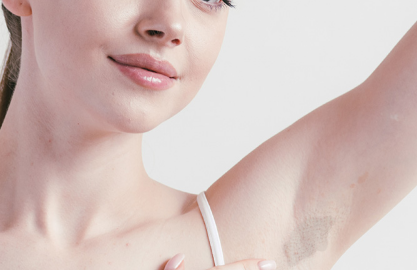 Causas comunes del oscurecimiento en las axilas