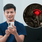 ¿Tu cerebro se encoge por tiktok? Científicos realizaron estudio al respecto