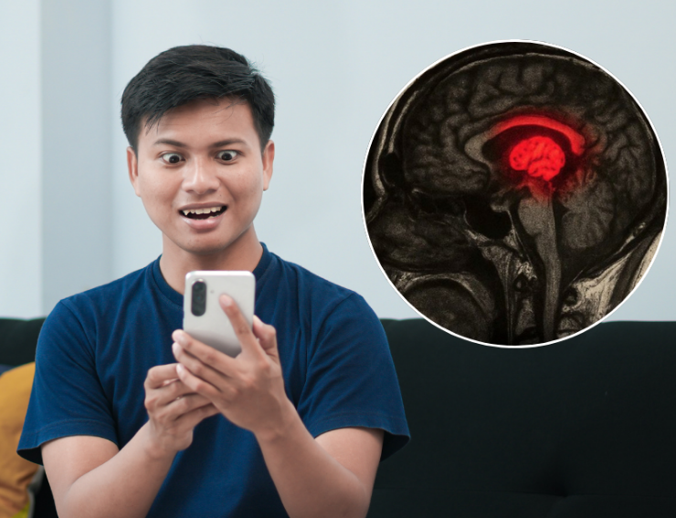 ¿Tu cerebro se encoge por tiktok? Científicos realizaron estudio al respecto