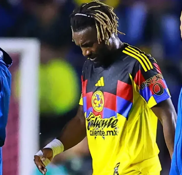 Lesionados en el Club América encienden alarmas en Coapa