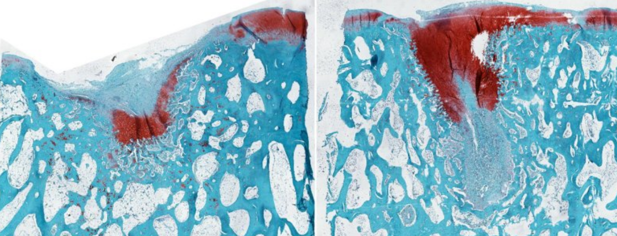 La importancia del cartílago en la movilidad humana