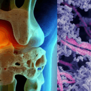 Crean biomaterial para reparar cartílagos dañados en nuestras articulaciones