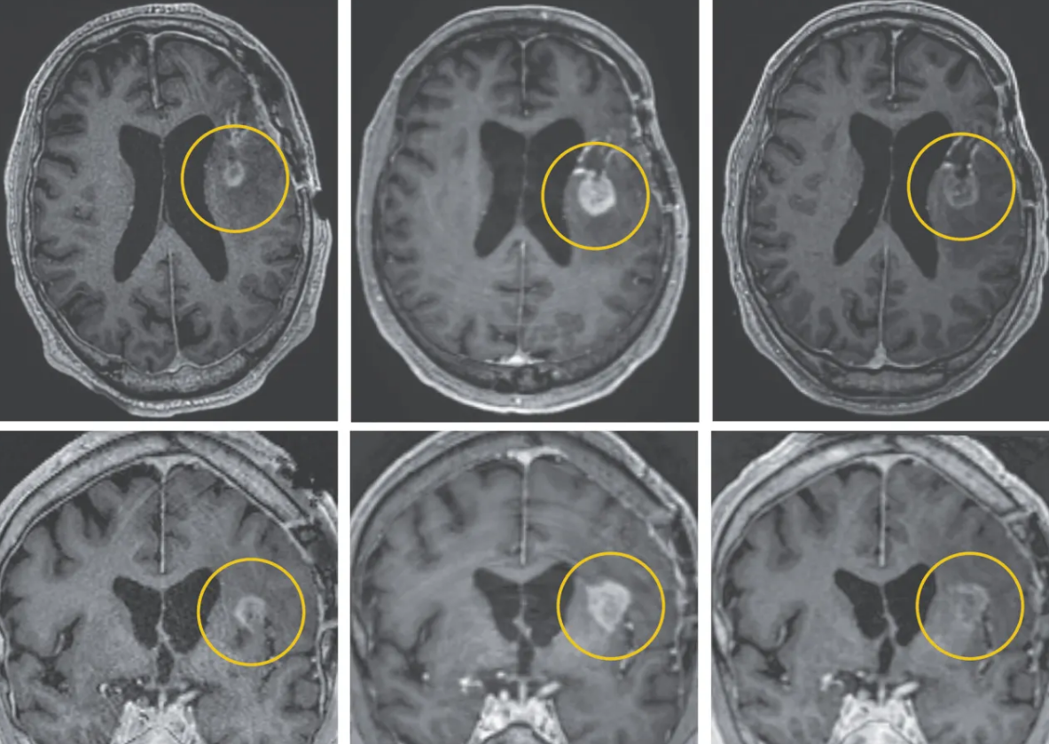 De laboratorio a intervención clínica acelerada