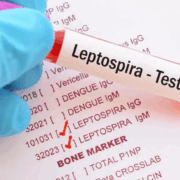 Autoridades de salud de Jamaica en alerta debido a extraños casos de leptospirosis