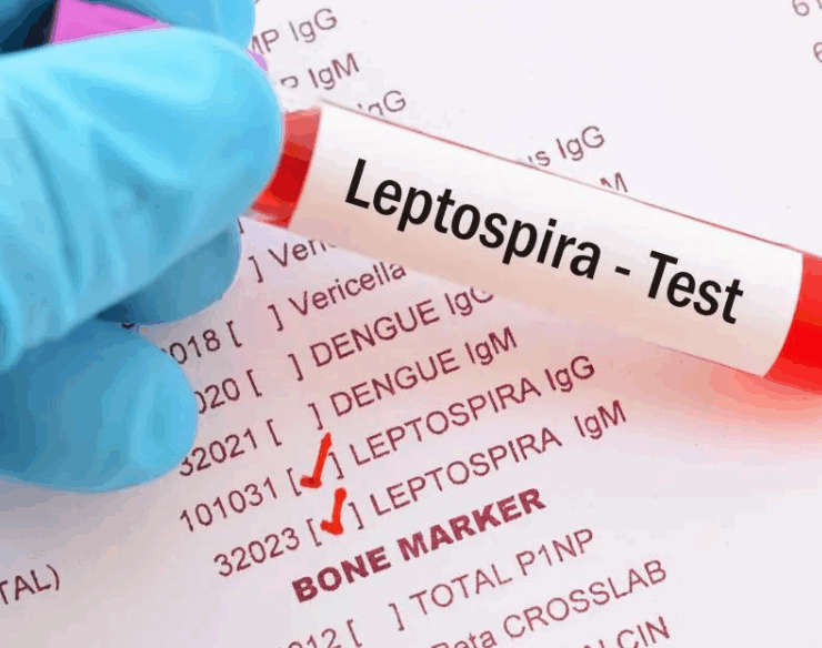 Autoridades de salud de Jamaica en alerta debido a extraños casos de leptospirosis