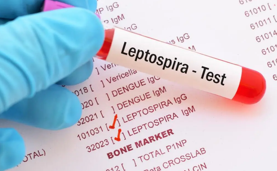 Autoridades de salud de Jamaica en alerta debido a extraños casos de leptospirosis