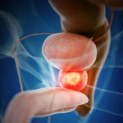 Movember 2025: Urgencia silenciosa en la salud masculina; el testimonio de José revela por qué la detección temprana del cáncer de próstata es vital