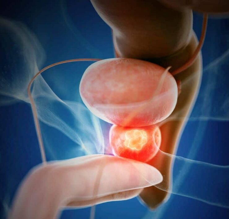 Movember 2025: Urgencia silenciosa en la salud masculina; el testimonio de José revela por qué la detección temprana del cáncer de próstata es vital