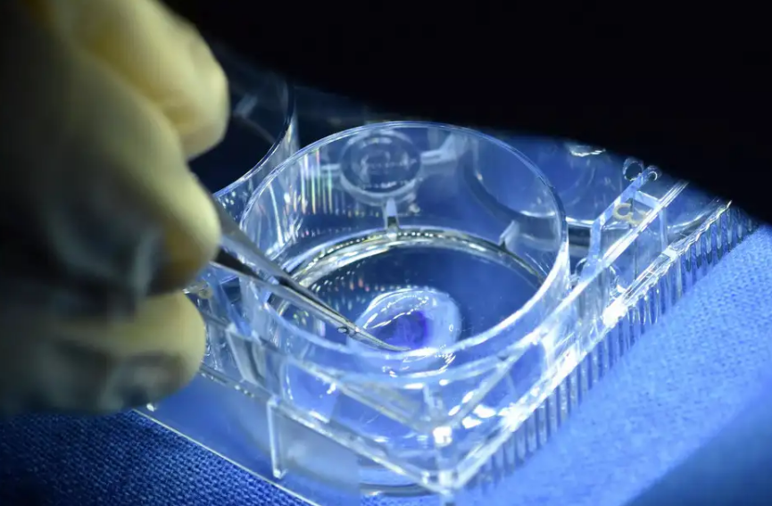 Beneficios clínicos y recuperación visual