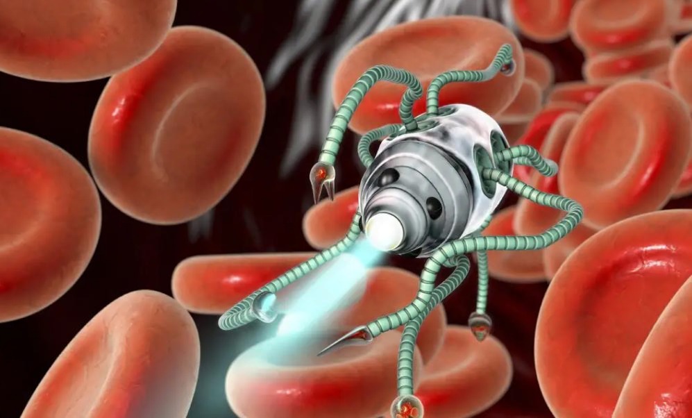 Nanobots luchan contra la presión arterial alta disolviendo la placa en segundos