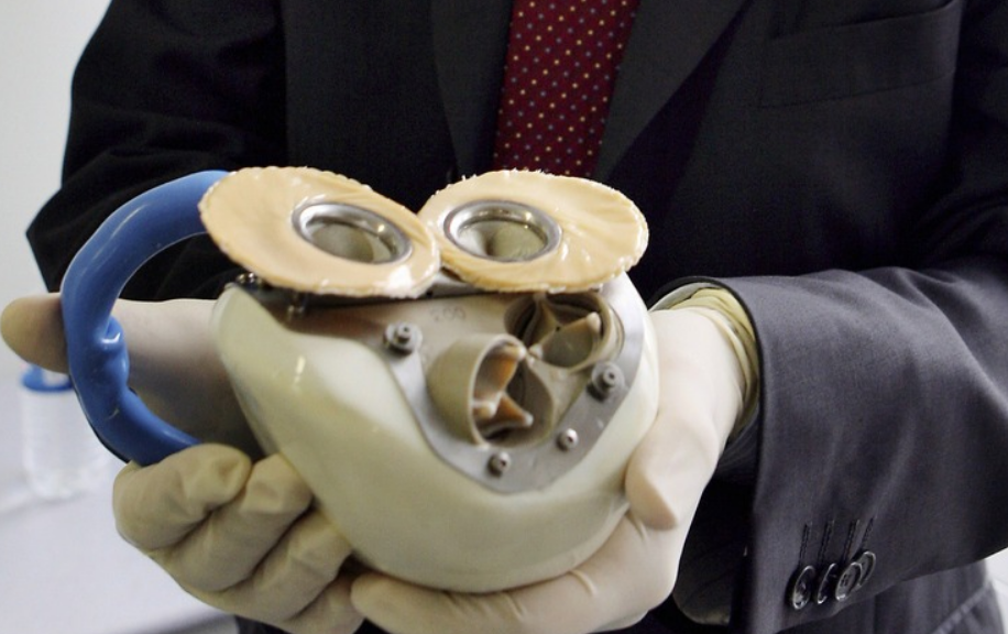 Beneficios y ventajas sobre los trasplantes tradicionales