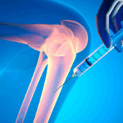 Una inyección de hidrogel fortalece los huesos y su densidad