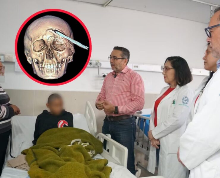 Histórica cirugía en Yucatán: IMSS salva a joven con una coa incrustada en la cabeza