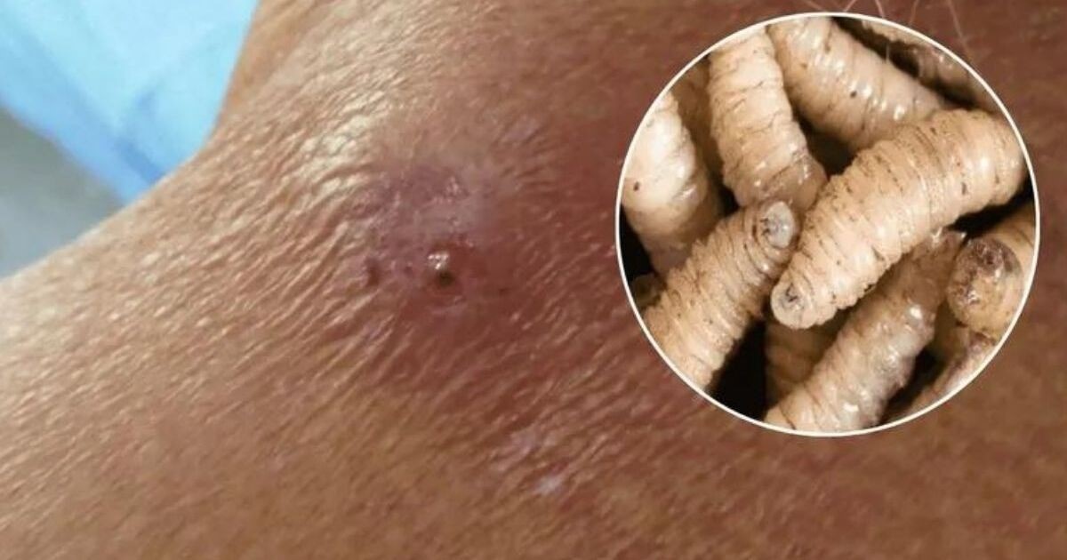 ¡Impactante! Séptimo caso de miasis en Yucatán pone en alerta a todos