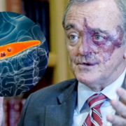 ¿España encuentra la cura contra el cáncer de páncreas?