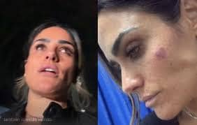 En transmisión en vivo, la alcaldesa mostró golpes y rasguños tras el enfrentamiento durante el operativo en San Cosme.