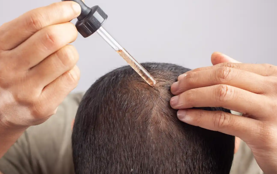 La ciencia detrás del “reinicio” folicular