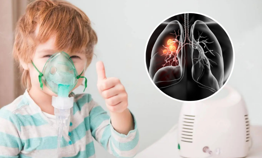 La primera Terapia genética inhalable, la ciencia avanza a pasos agigantados