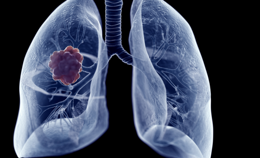 Resultados de los Ensayos Clínicos