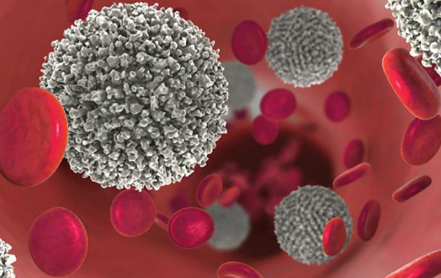 Terapia CAR-T en Vietnam y su impacto en la leucemia