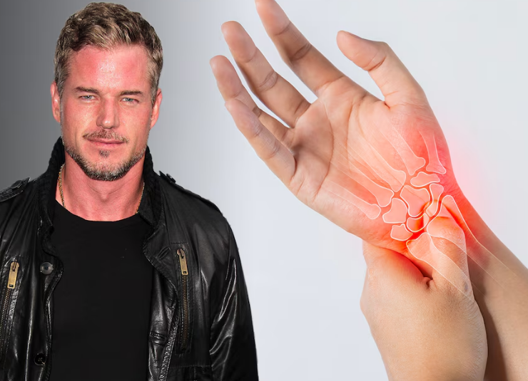 Eric Dane descubrió que tenía ELA gracias a este síntoma