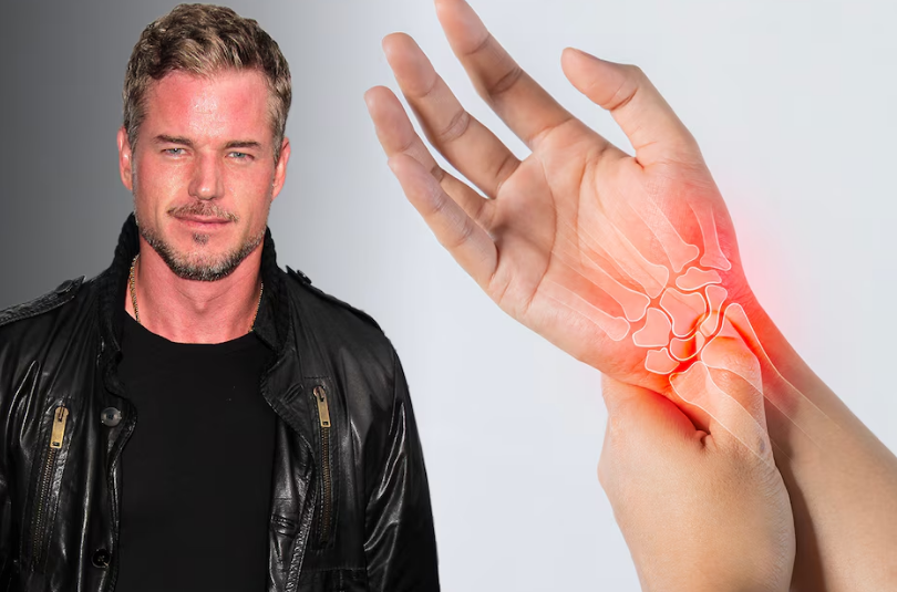Eric Dane descubrió que tenía ELA gracias a este síntoma