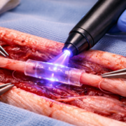 Una nueva forma de reparar nervios ha sido aprobada por la FDA