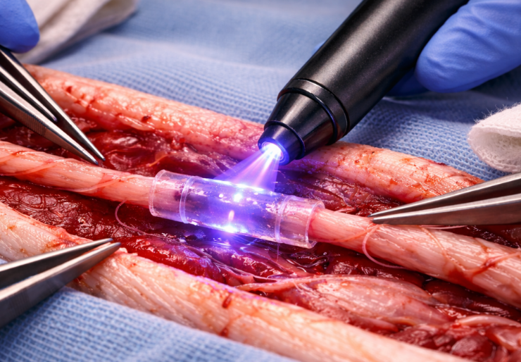 Una nueva forma de reparar nervios ha sido aprobada por la FDA