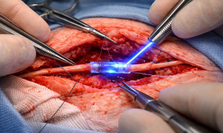 Cómo funciona el polímero activado por luz