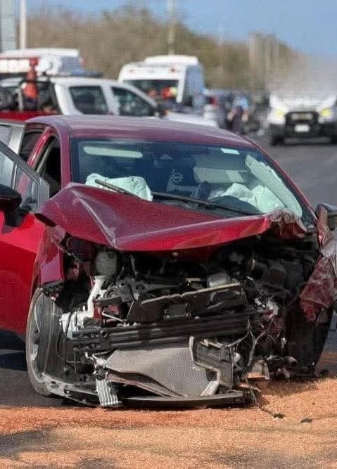 Brutal choque frontal en la Conkal–Mocochá deja varios lesionados