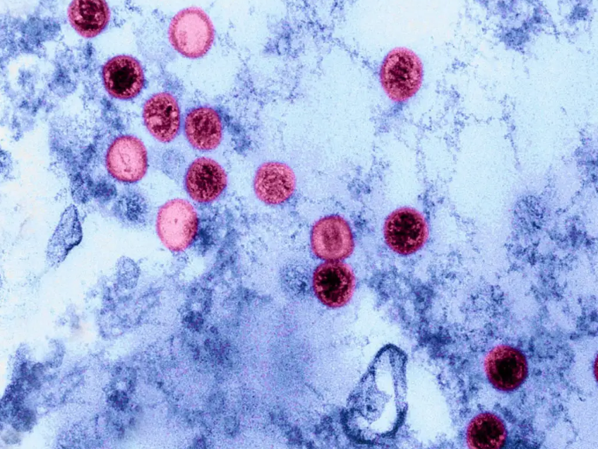 virus marino podría haber saltado a humanos y evidencia CMNV