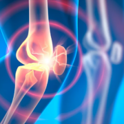 Nuevo fármaco experimental podría revertir la osteoartritis