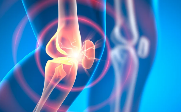 Nuevo fármaco experimental podría revertir la osteoartritis
