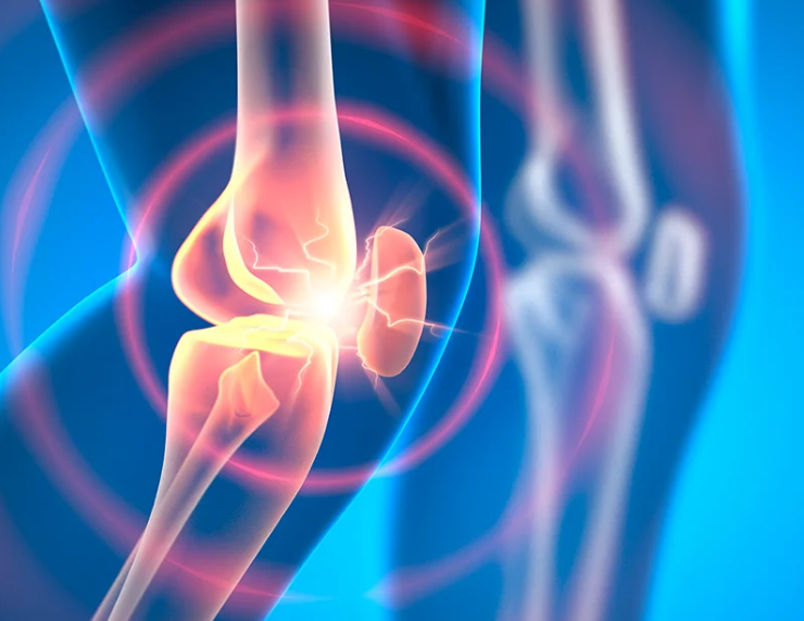 Nuevo fármaco experimental podría revertir la osteoartritis