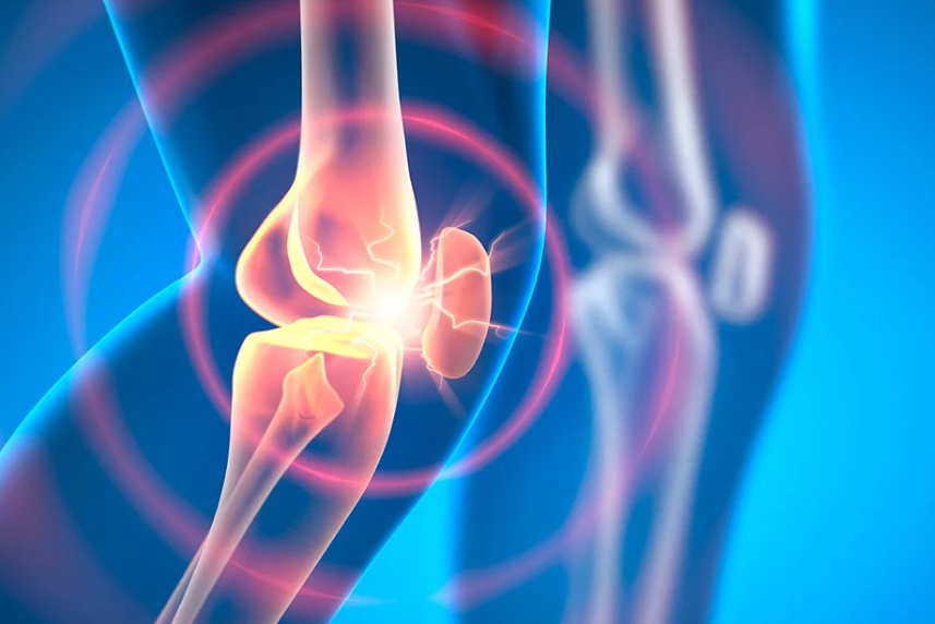 Nuevo fármaco experimental podría revertir la osteoartritis