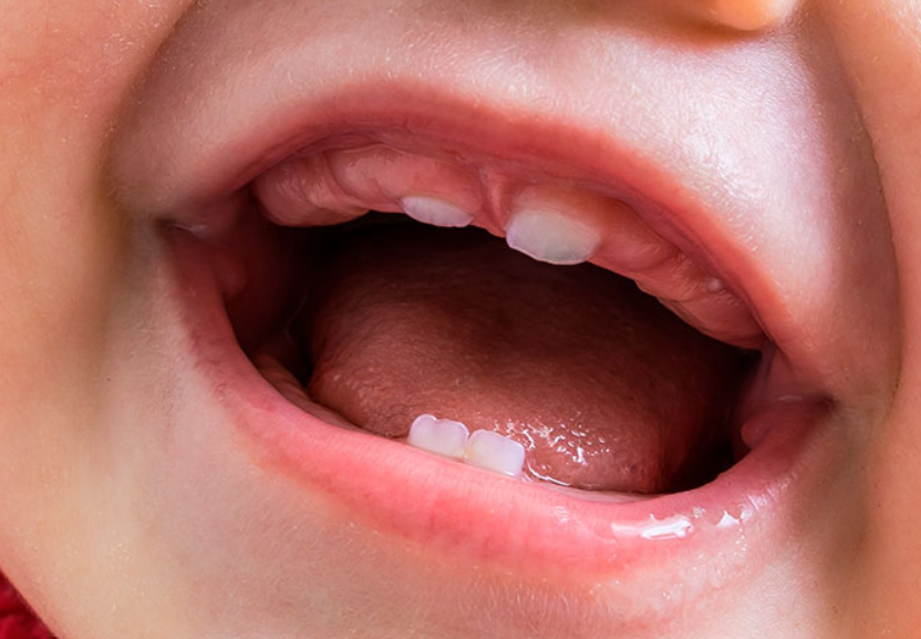 Activación de proteínas clave en el crecimiento dental