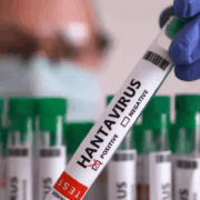 Tabasco descarta riesgo por hantavirus