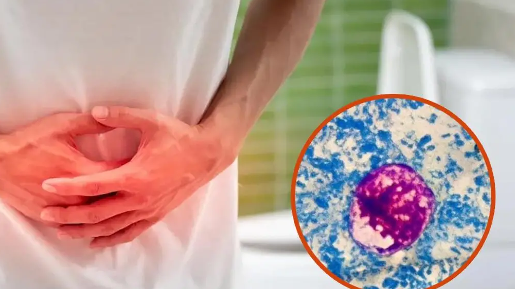 Qué es la ciclosporiasis y cómo prevenirla