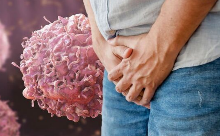 Se dispara ciclosporiasis en Texas, fuerte infección intestinal