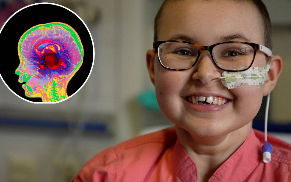 Nueva terapia muestra resultados prometedores contra tumores cerebrales