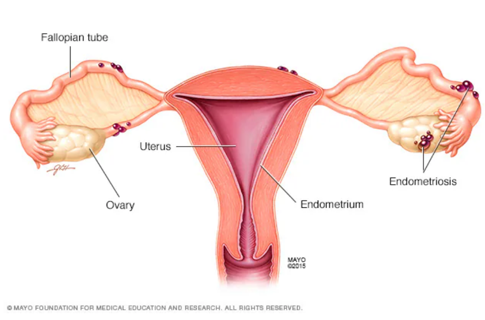 Entendiendo la salud femenina en Campeche
