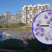 Yucatán mantiene aislado el lago donde se confirmó Naegleria fowleri; investigará y sancionará a los responsables