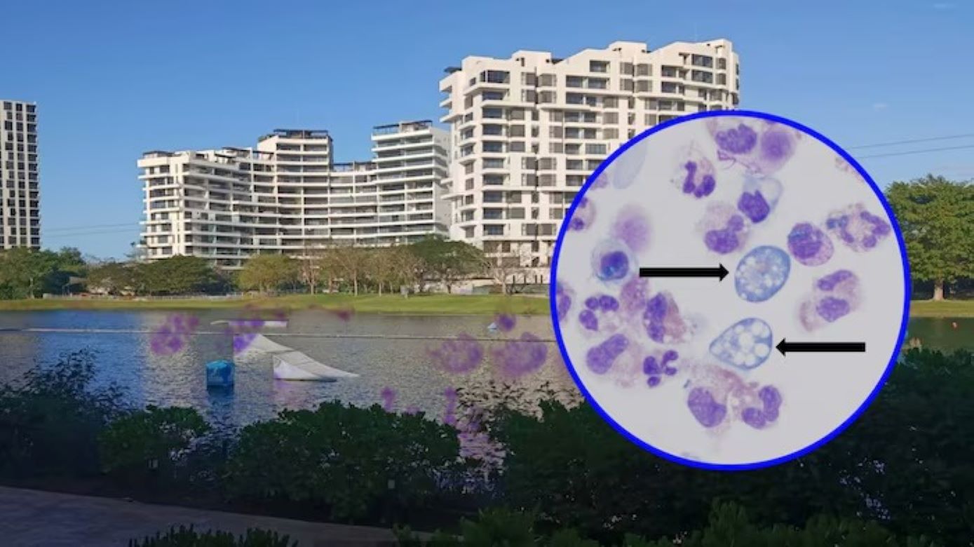 Yucatán mantiene aislado el lago donde se confirmó Naegleria fowleri; investigará y sancionará a los responsables