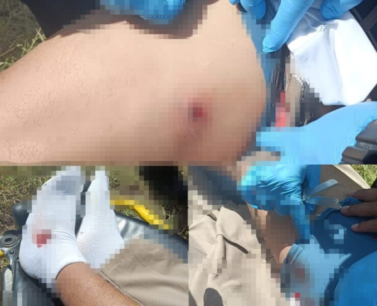 ¡Impactante! Balines lesionan a motociclista en carretera Tizimín-Río Lagartos