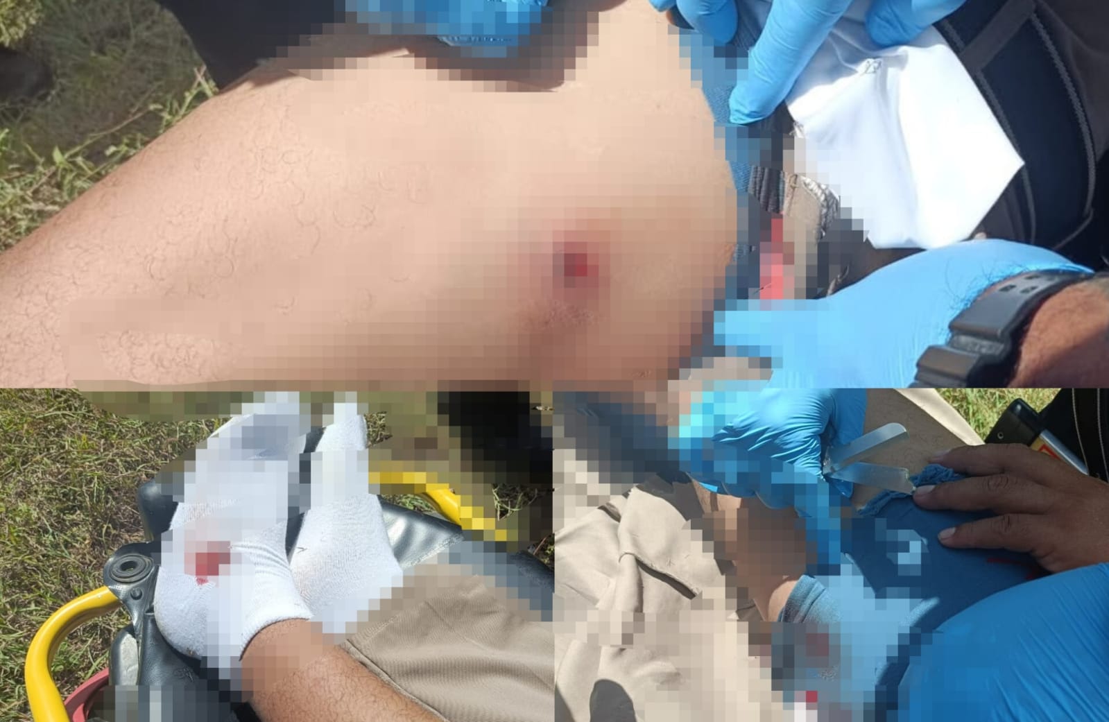 ¡Impactante! Balines lesionan a motociclista en carretera Tizimín-Río Lagartos